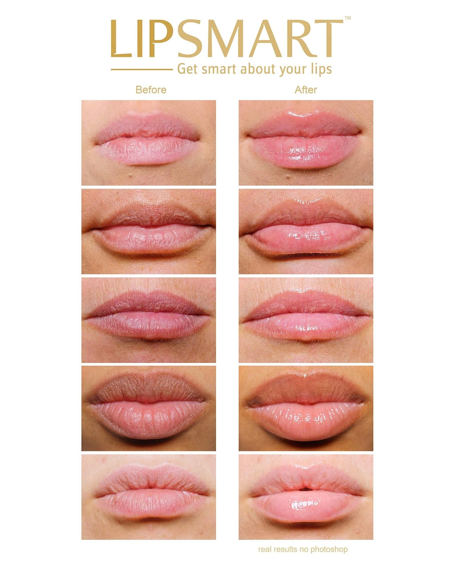 LIPSMART