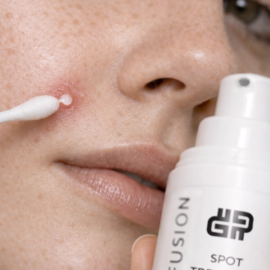 PoreInfusion Spot Treat Active